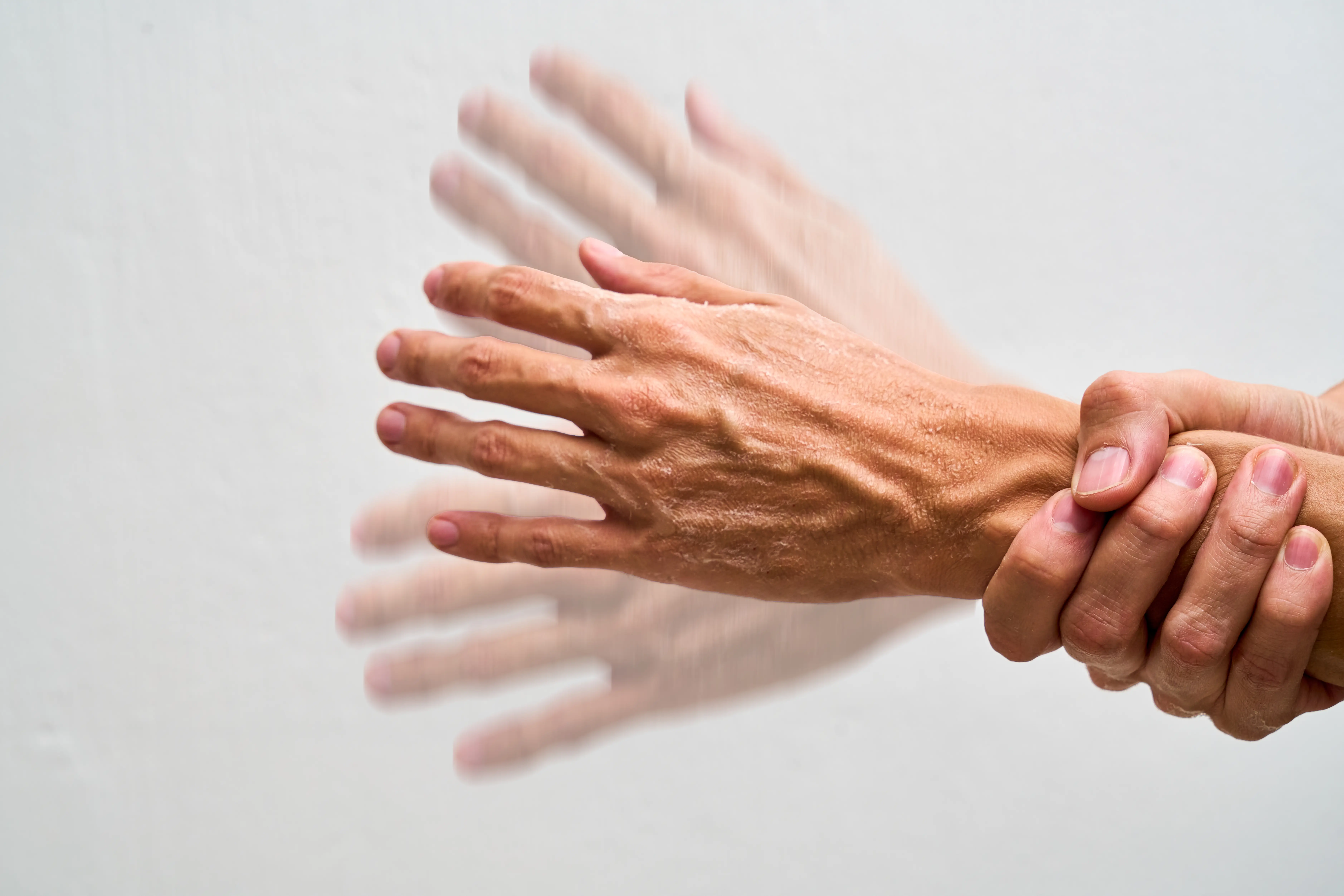 Movement Disorders: Parkinson's Disease, Symptoms & Therapy I PMC