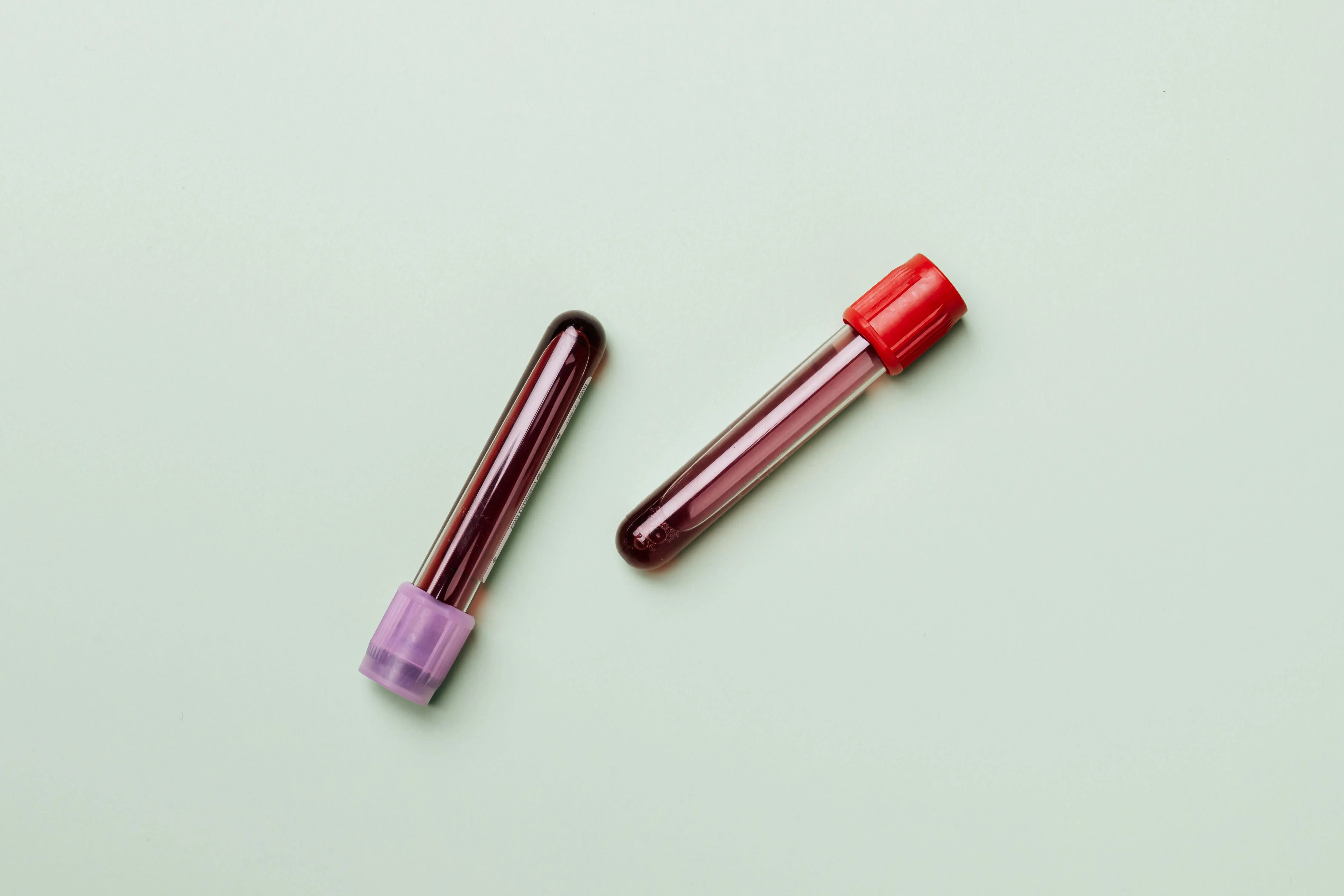 Röhrchen mit Blut