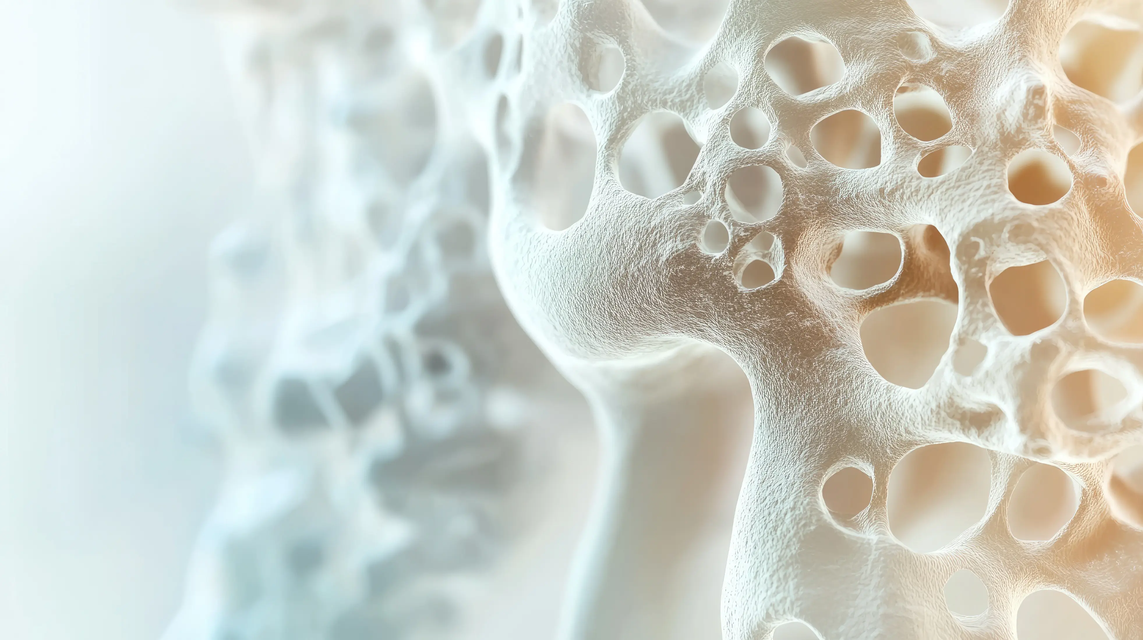 Mikroskopische Aufnahmen brüchiger Knochen Osteoporose